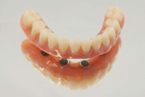 Fabien Bootz - Chirurgien dentiste - prothèses dentaires sur implant