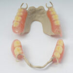 Fabien Bootz - Chirurgien dentiste - prothèse dentaire amovible